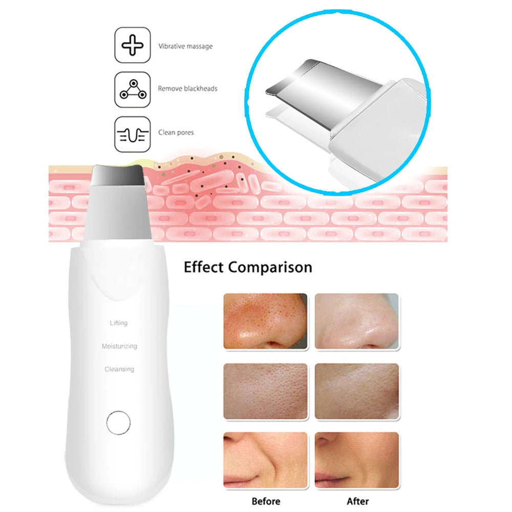 Ultrasonic Skin Scrubber | Deep Facial Cleanser Spatula