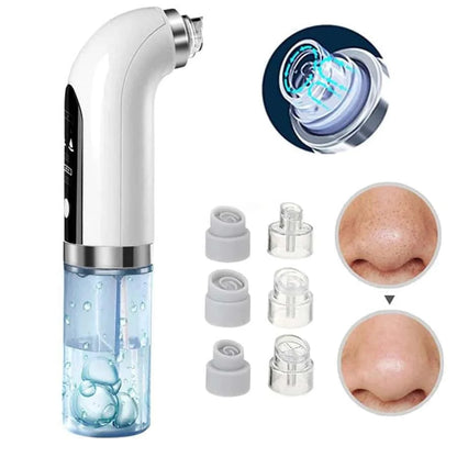 Professional Pore Vacuum | Blackhead Remover for Clear Skin