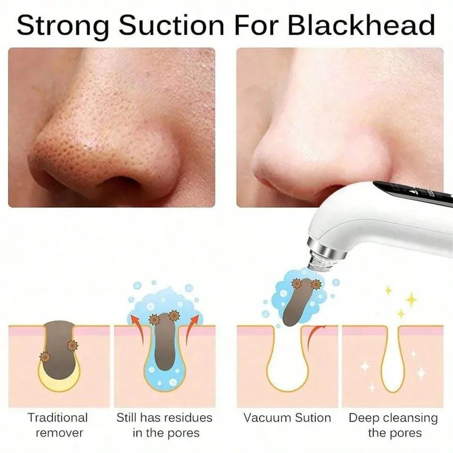 Professional Pore Vacuum | Blackhead Remover for Clear Skin